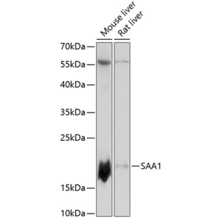 Western Blot - Anti-Serum Amyloid A Antibody (A88443) - Antibodies.com