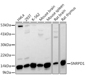 Western Blot - Anti-SNRPD1 Antibody (A88444) - Antibodies.com