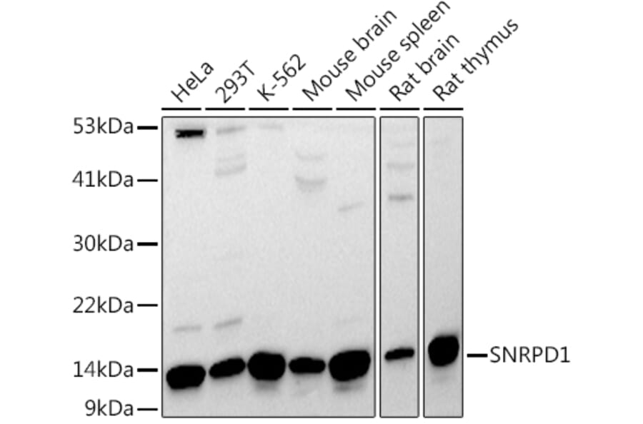 Western Blot - Anti-SNRPD1 Antibody (A88444) - Antibodies.com