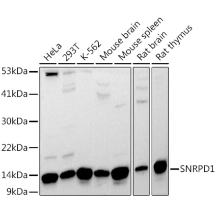 Western Blot - Anti-SNRPD1 Antibody (A88444) - Antibodies.com