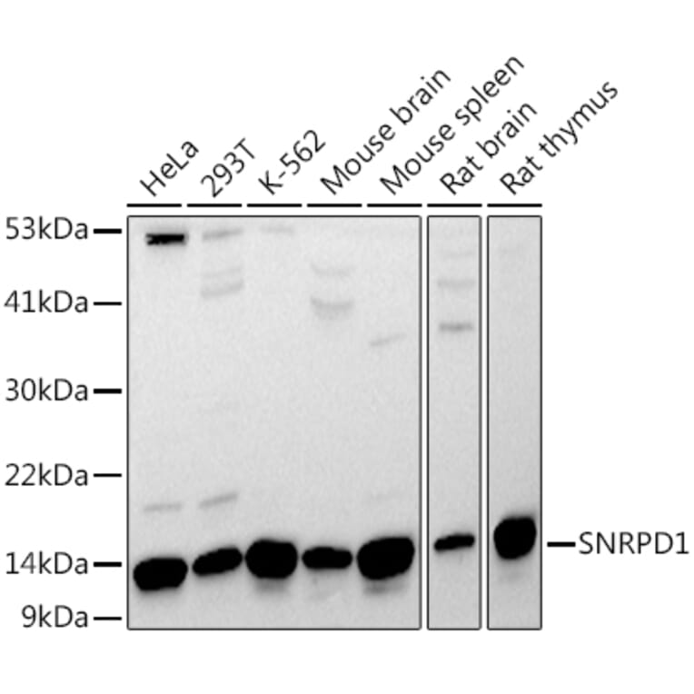 Western Blot - Anti-SNRPD1 Antibody (A88444) - Antibodies.com