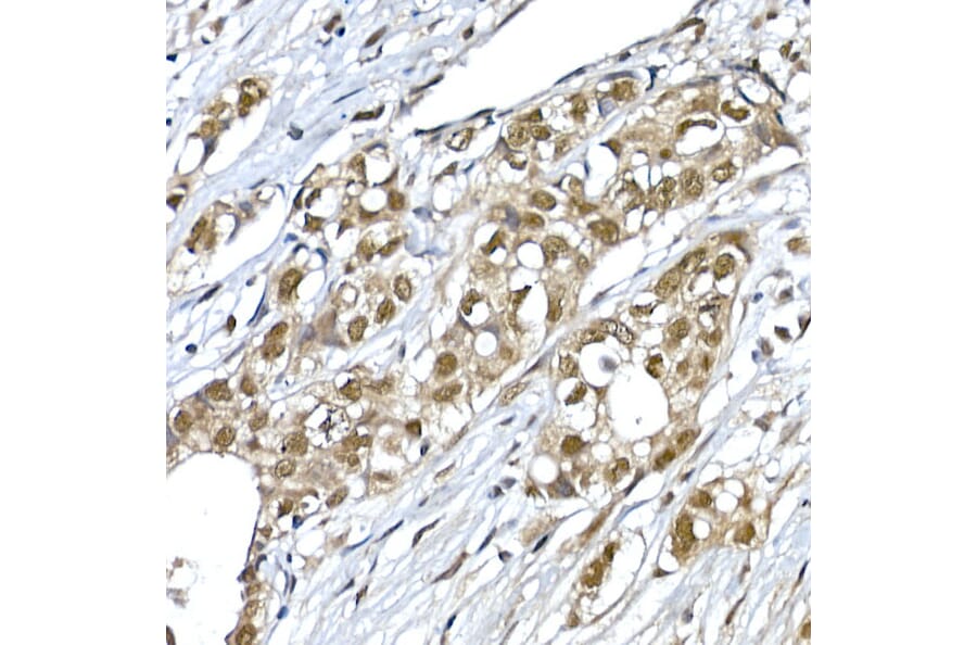 Immunohistochemistry - Anti-SNRPD1 Antibody (A88444) - Antibodies.com