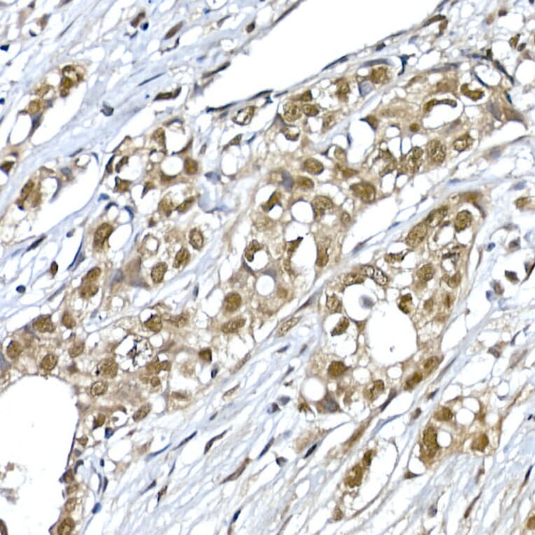 Immunohistochemistry - Anti-SNRPD1 Antibody (A88444) - Antibodies.com