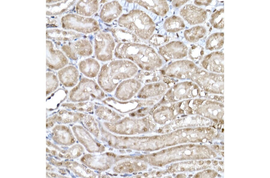 Immunohistochemistry - Anti-SNRPD1 Antibody (A88444) - Antibodies.com