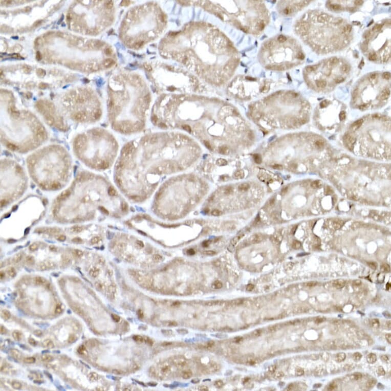 Immunohistochemistry - Anti-SNRPD1 Antibody (A88444) - Antibodies.com