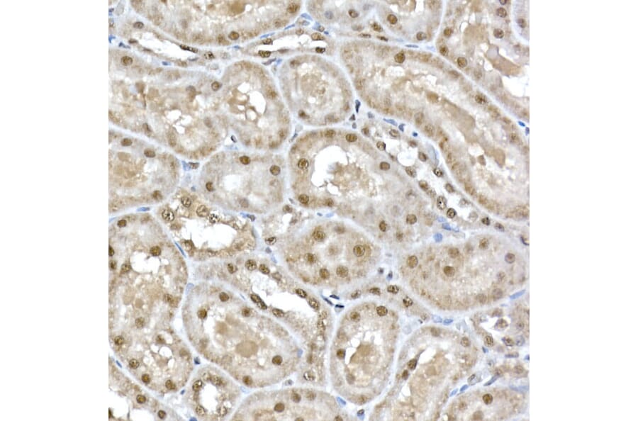 Immunohistochemistry - Anti-SNRPD1 Antibody (A88444) - Antibodies.com