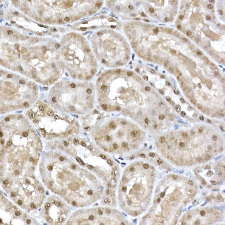 Immunohistochemistry - Anti-SNRPD1 Antibody (A88444) - Antibodies.com