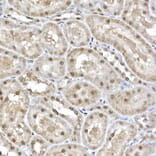 Immunohistochemistry - Anti-SNRPD1 Antibody (A88444) - Antibodies.com