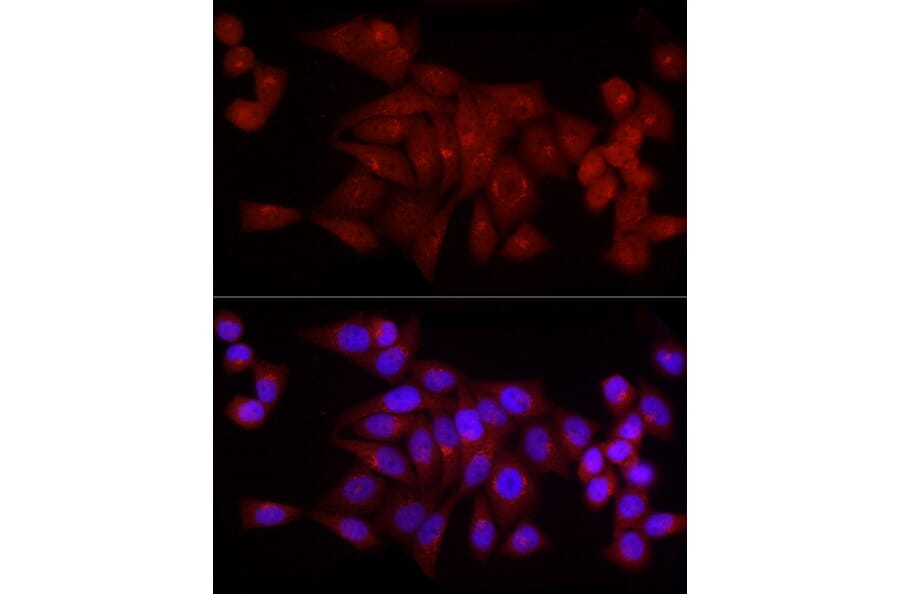 Immunofluorescence - Anti-SNRPD1 Antibody (A88444) - Antibodies.com
