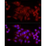 Immunofluorescence - Anti-SNRPD1 Antibody (A88444) - Antibodies.com