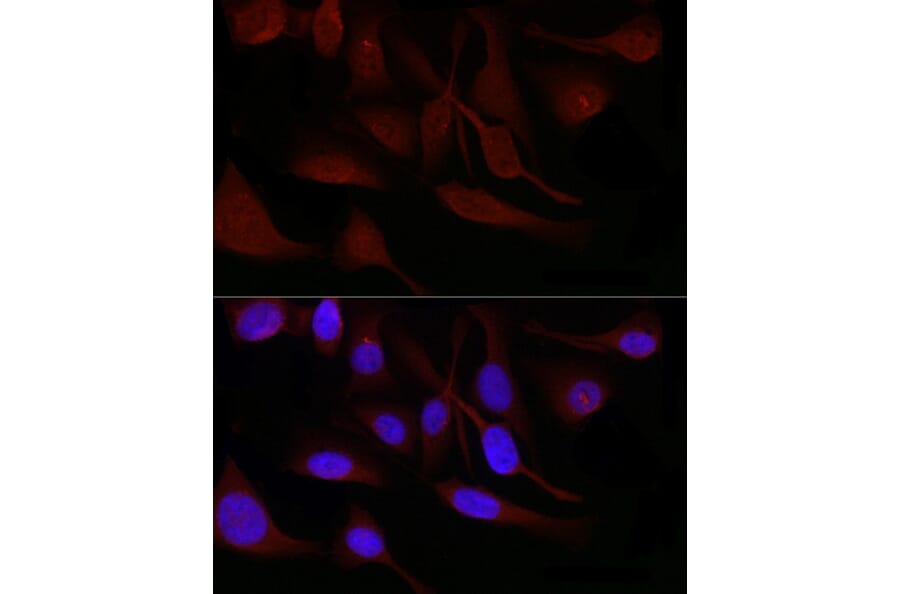 Immunofluorescence - Anti-SNRPD1 Antibody (A88444) - Antibodies.com