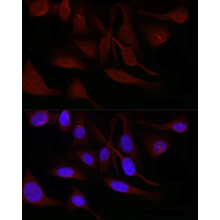 Immunofluorescence - Anti-SNRPD1 Antibody (A88444) - Antibodies.com