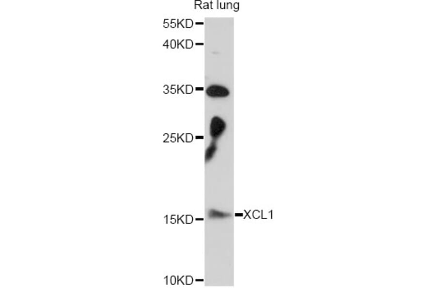 Western Blot - Anti-XCL1 Antibody (A14490) - Antibodies.com