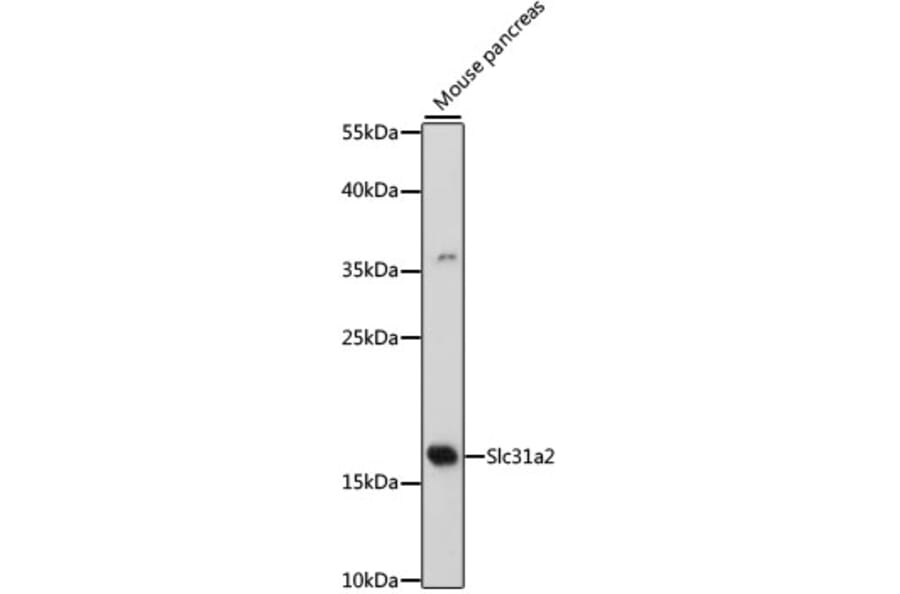 Western Blot - Anti-COPT2 Antibody (A88446) - Antibodies.com