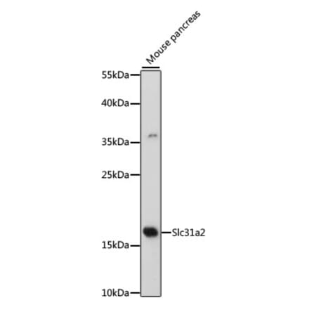Western Blot - Anti-COPT2 Antibody (A88446) - Antibodies.com