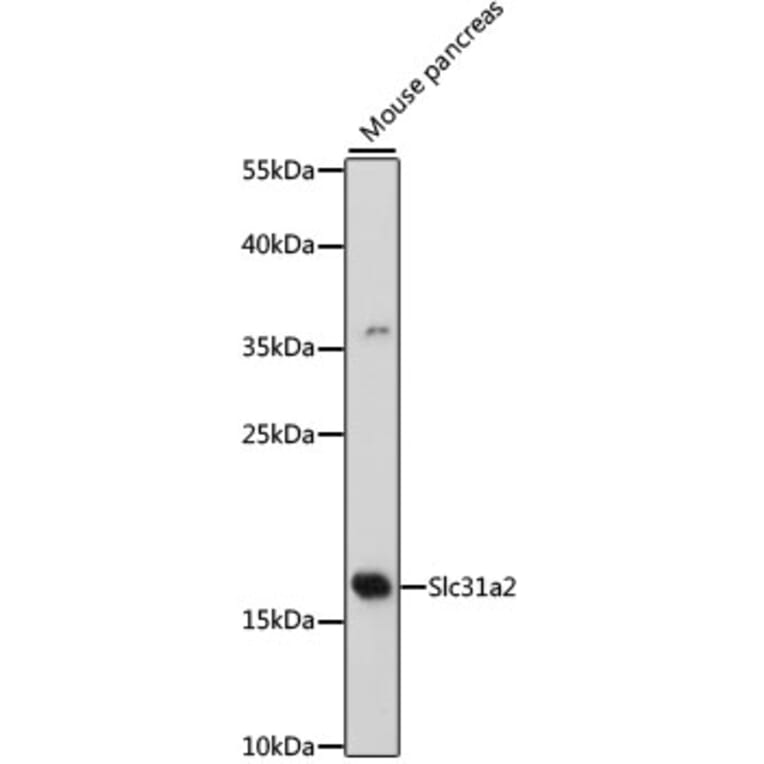 Western Blot - Anti-COPT2 Antibody (A88446) - Antibodies.com