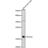 Western Blot - Anti-COPT2 Antibody (A88446) - Antibodies.com