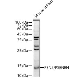Western Blot - Anti-PEN2 Antibody (A88448) - Antibodies.com