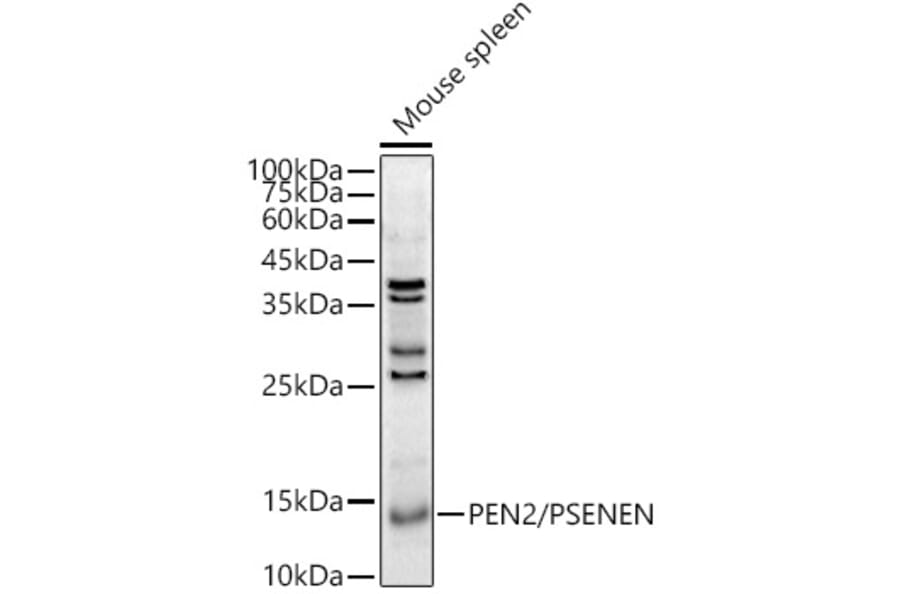 Western Blot - Anti-PEN2 Antibody (A88448) - Antibodies.com