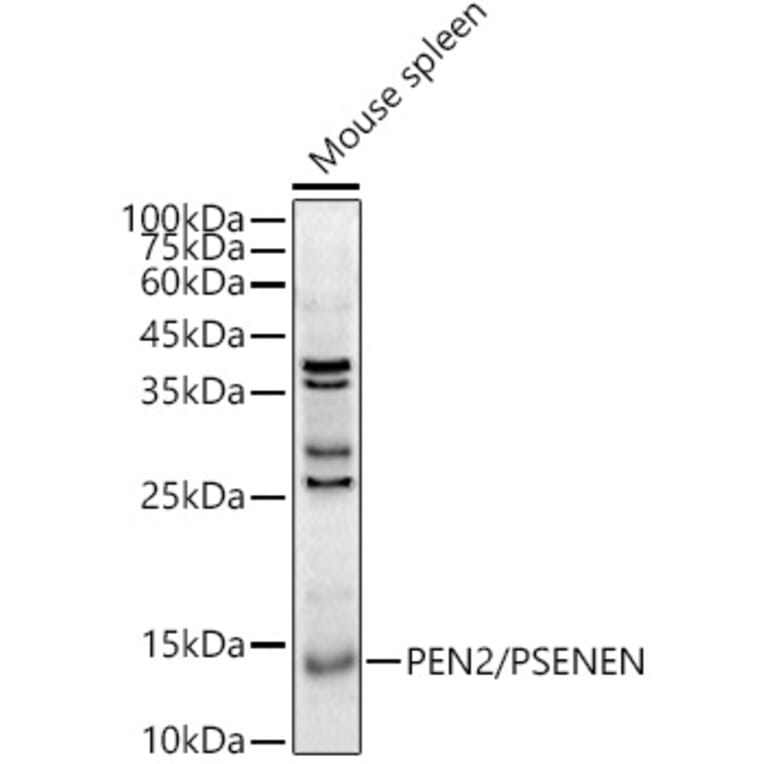 Western Blot - Anti-PEN2 Antibody (A88448) - Antibodies.com