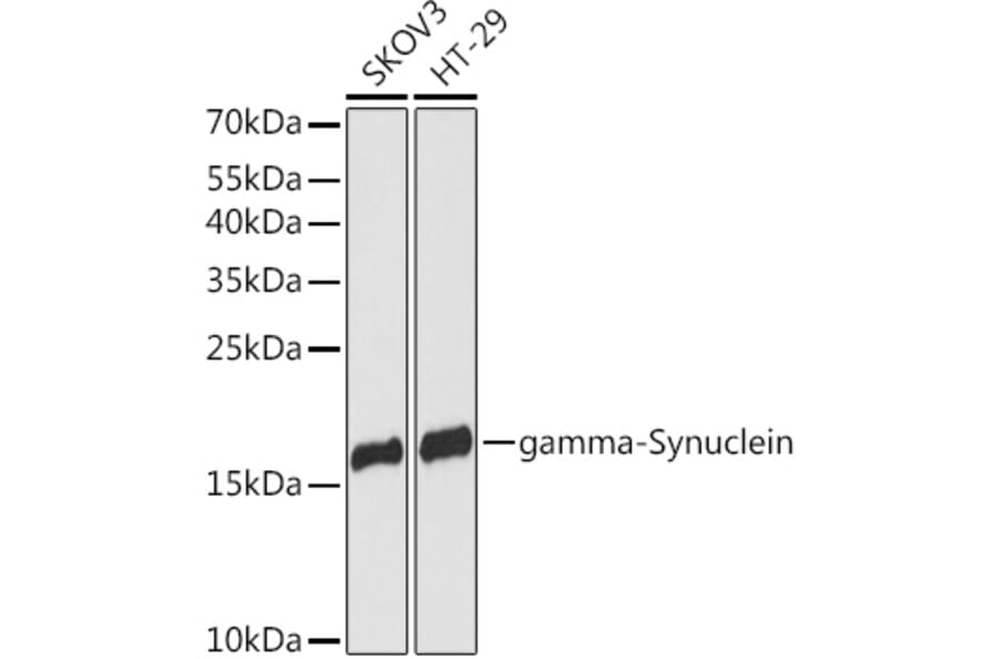 Western Blot - Anti-gamma Synuclein/SNCG Antibody (A88449) - Antibodies.com