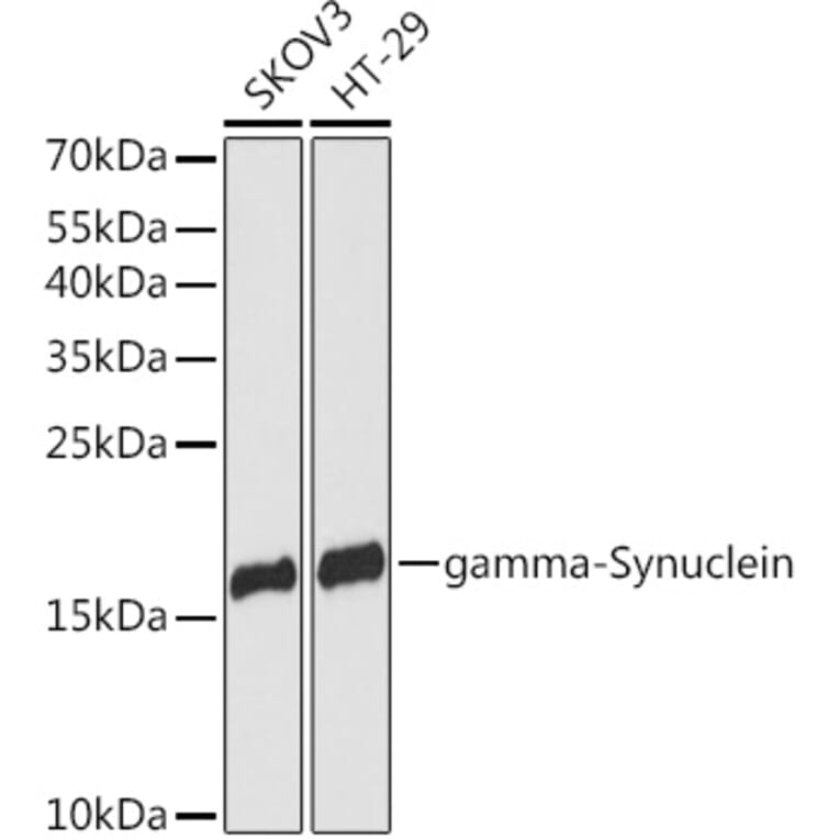 Western Blot - Anti-gamma Synuclein/SNCG Antibody (A88449) - Antibodies.com