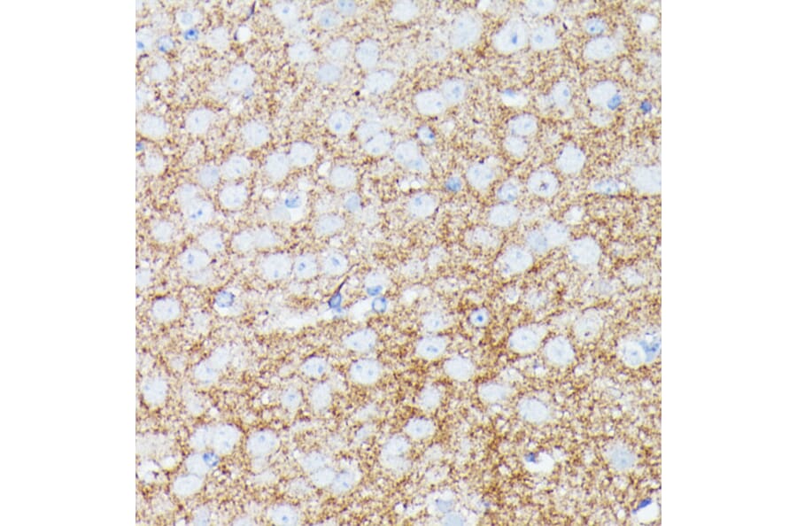 Immunohistochemistry - Anti-gamma Synuclein/SNCG Antibody (A88449) - Antibodies.com