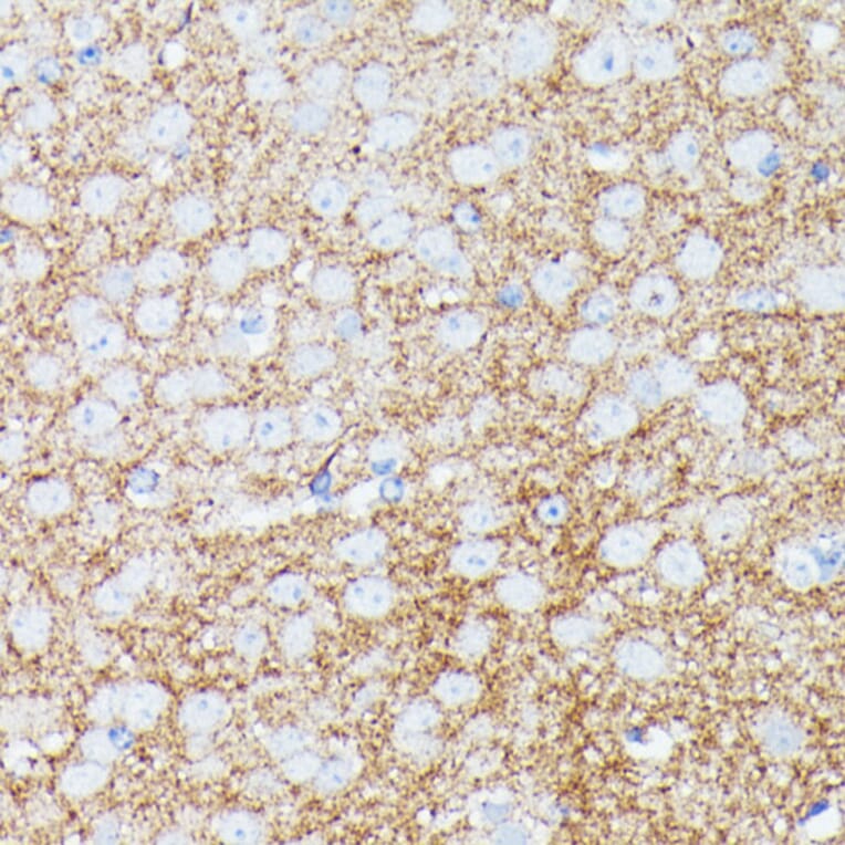Immunohistochemistry - Anti-gamma Synuclein/SNCG Antibody (A88449) - Antibodies.com