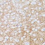 Immunohistochemistry - Anti-gamma Synuclein/SNCG Antibody (A88449) - Antibodies.com