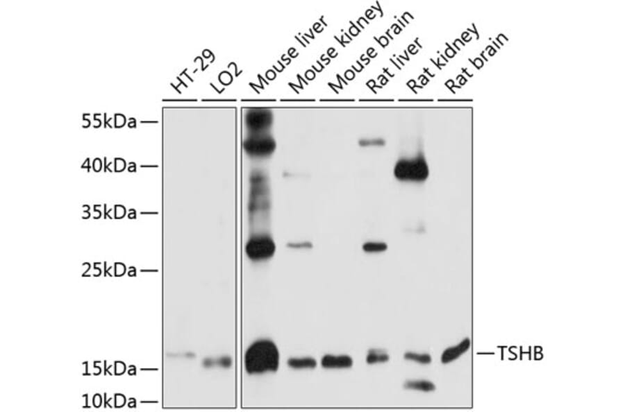 Western Blot - Anti-TSH beta Antibody (A88450) - Antibodies.com