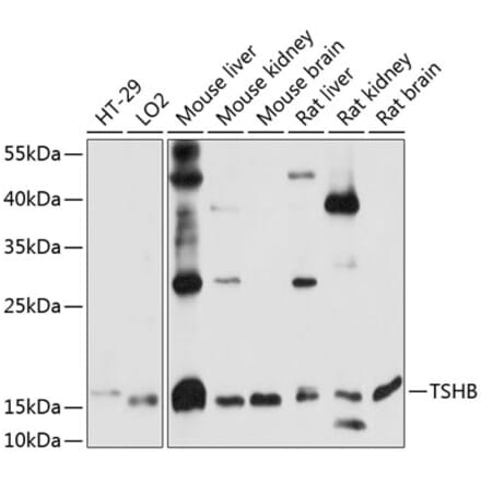 Western Blot - Anti-TSH beta Antibody (A88450) - Antibodies.com