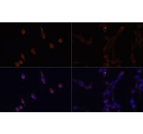 Immunofluorescence - Anti-LC3B Antibody (A88451) - Antibodies.com