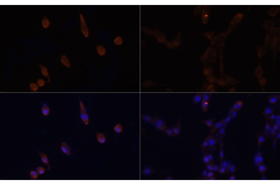 Immunofluorescence - Anti-LC3B Antibody (A88451) - Antibodies.com