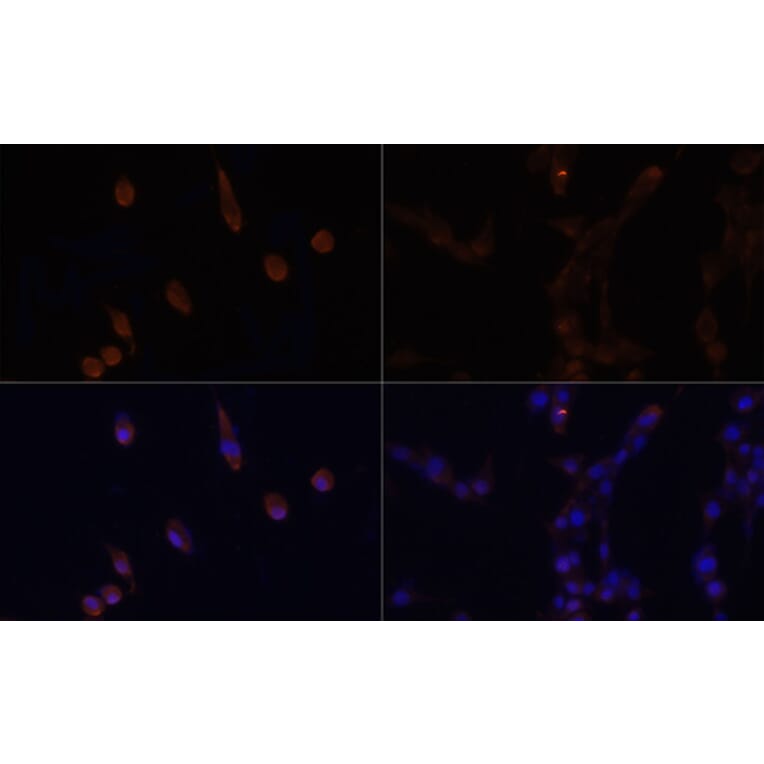 Immunofluorescence - Anti-LC3B Antibody (A88451) - Antibodies.com