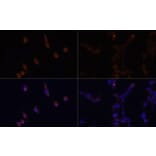 Immunofluorescence - Anti-LC3B Antibody (A88451) - Antibodies.com