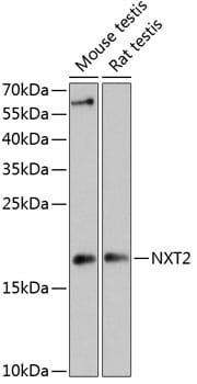 Western blot analysis of extracts of various cell lines, using Anti-NXT2 Antibody (A13822) at 1:3000 dilution.
Secondary antibody: Goat Anti-Rabbit IgG (H+L) (HRP) (AS014) at 1:10,000 dilution.
Lysates / proteins: 25µg per lane.
Blocking buffer: 3% non-fat dry milk in TBST.
Detection: ECL Enhanced Kit (RM00021).
Exposure time: 90s.