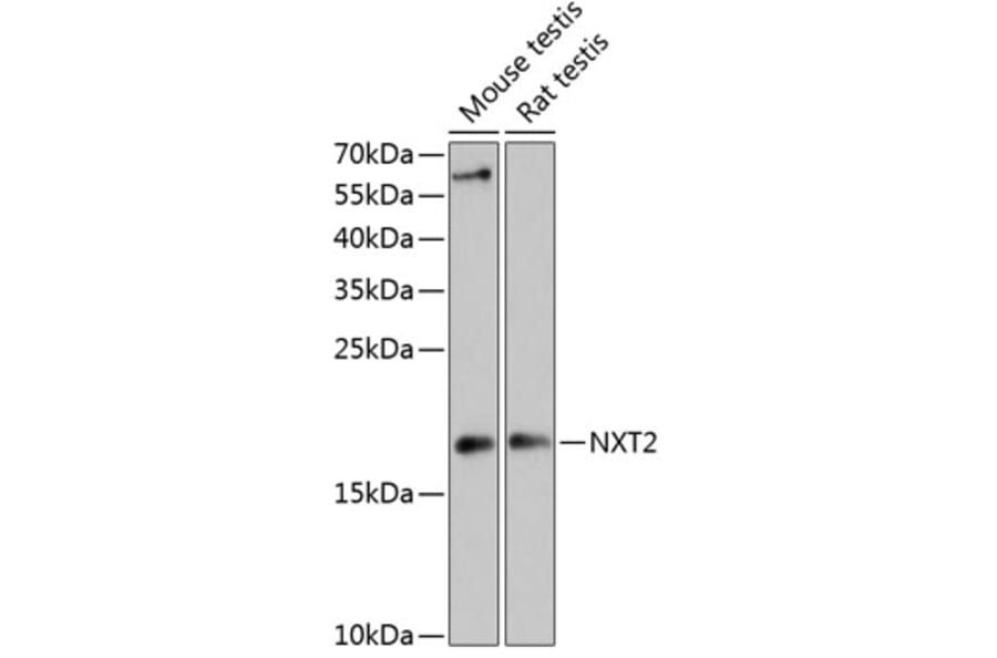 Western Blot - Anti-NXT2 Antibody (A88452) - Antibodies.com