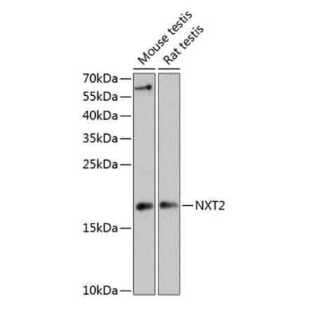 Western Blot - Anti-NXT2 Antibody (A88452) - Antibodies.com