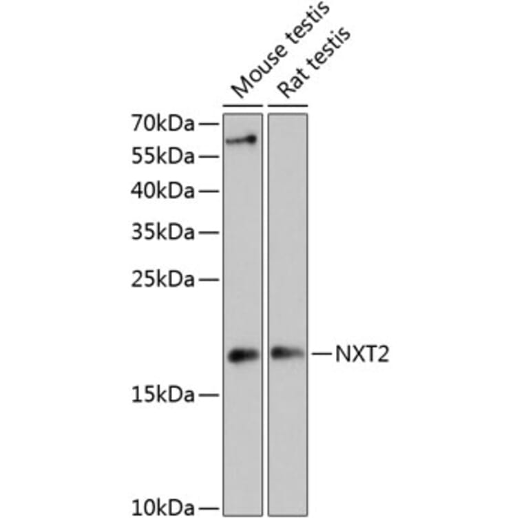 Western Blot - Anti-NXT2 Antibody (A88452) - Antibodies.com