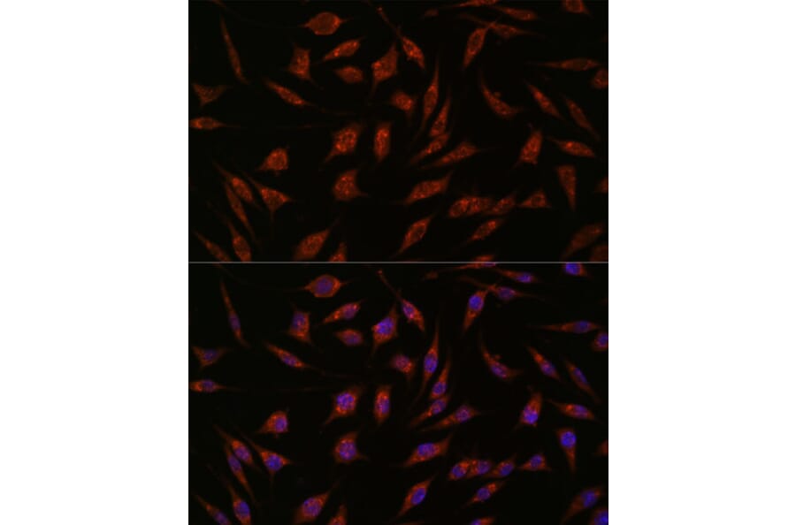 Immunofluorescence - Anti-NXT2 Antibody (A88452) - Antibodies.com