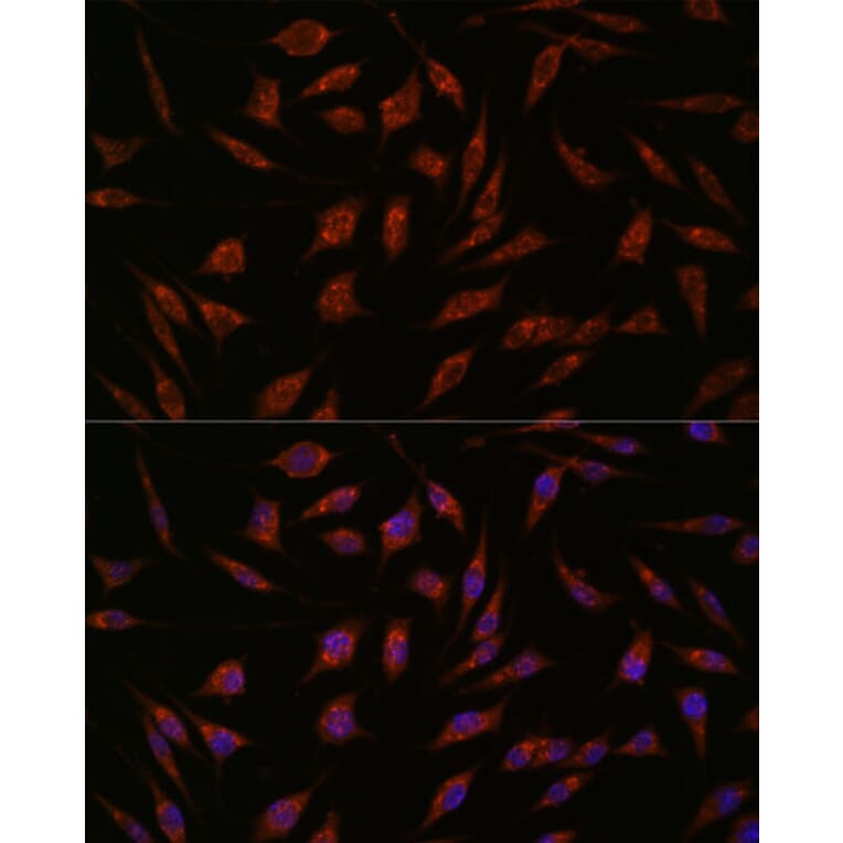 Immunofluorescence - Anti-NXT2 Antibody (A88452) - Antibodies.com