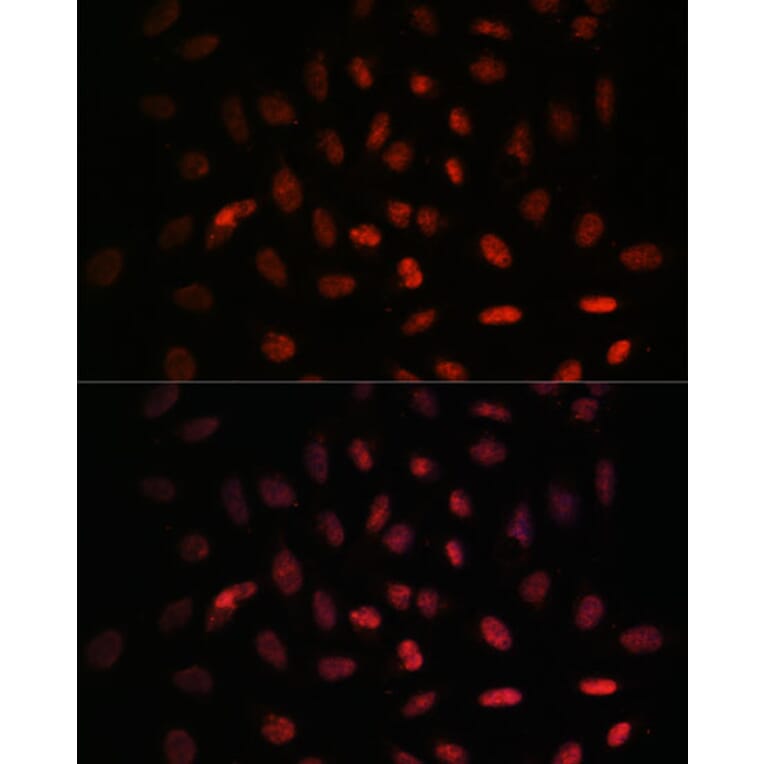 Immunofluorescence - Anti-NXT2 Antibody (A88452) - Antibodies.com