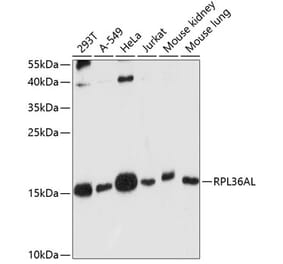 Western Blot - Anti-RPL36AL Antibody (A88453) - Antibodies.com