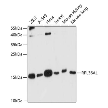 Western Blot - Anti-RPL36AL Antibody (A88453) - Antibodies.com