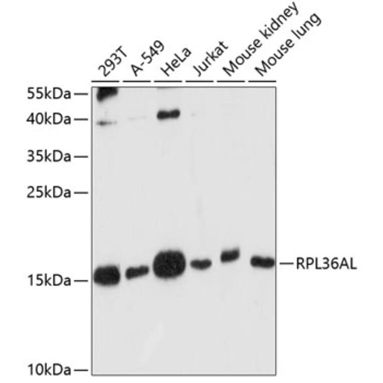 Western Blot - Anti-RPL36AL Antibody (A88453) - Antibodies.com