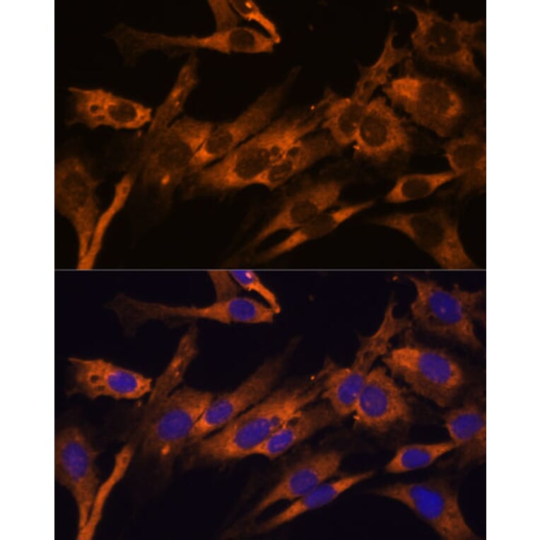Immunofluorescence - Anti-RPL36AL Antibody (A88453) - Antibodies.com