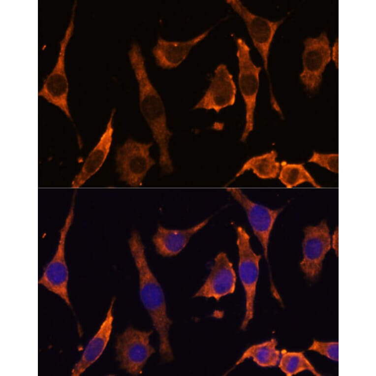 Immunofluorescence - Anti-RPL36AL Antibody (A88453) - Antibodies.com