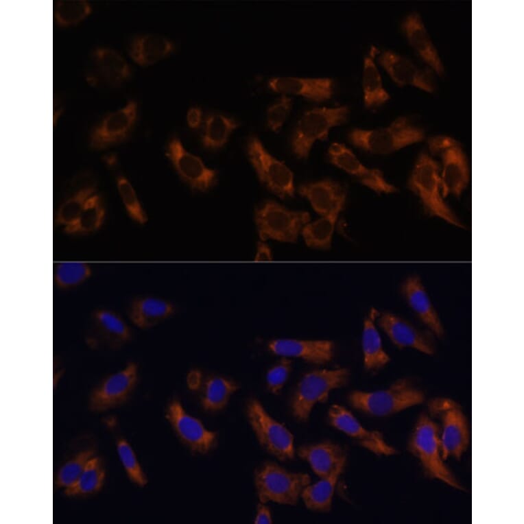 Immunofluorescence - Anti-RPL36AL Antibody (A88453) - Antibodies.com