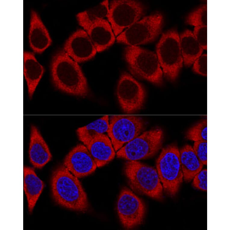 Immunofluorescence - Anti-RPL36AL Antibody (A88453) - Antibodies.com