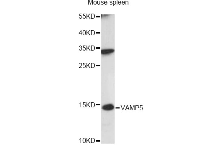 Western Blot - Anti-VAMP5 Antibody (A14371) - Antibodies.com